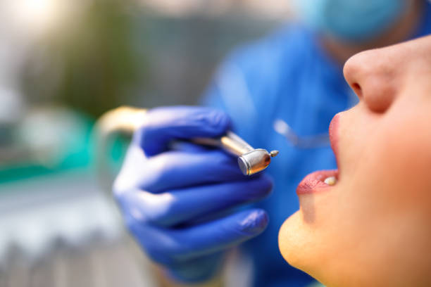 Best Teeth Whitening  in Lompoc, CA